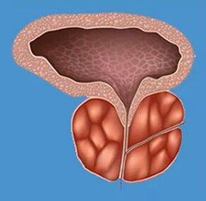 Charakteristische Anzeichen einer Prostatitis