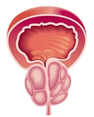 Symptome einer Prostatitis bei Männern.