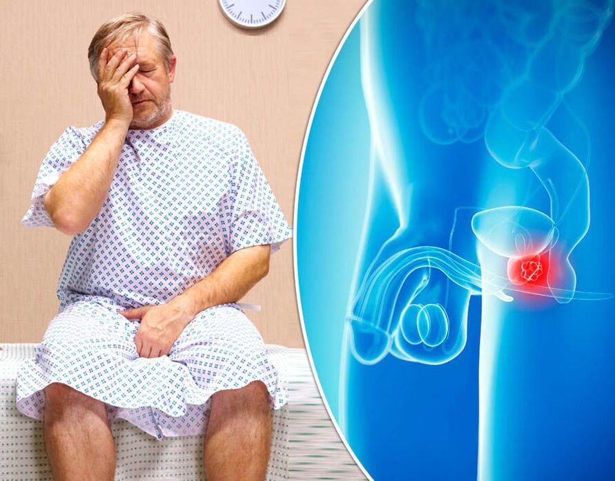 Bei einem Mann mit Prostatitis wird die Krankheit diagnostiziert.